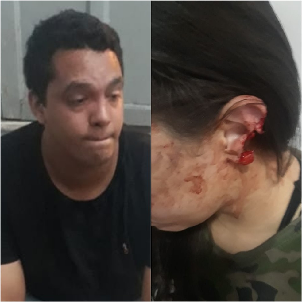 Homem é preso após morder e arrancar parte da orelha da esposa em Imperatriz